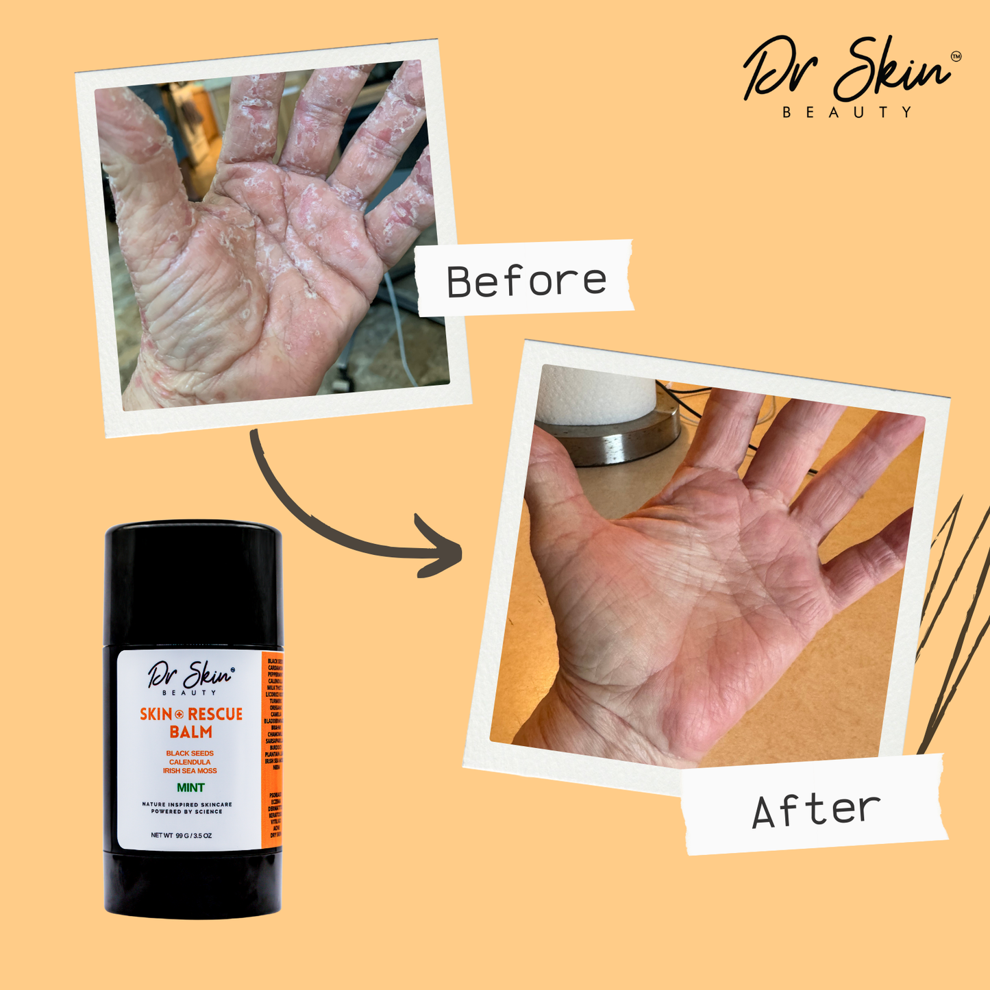 Dr. Skin Rescue Balm Stick - 20+ Botanicals for Problem Skin | Neem, Sea Moss & Black Seed