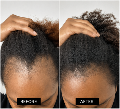 Hair Rescue Oil — Botanical Scalp & Strand Ritual