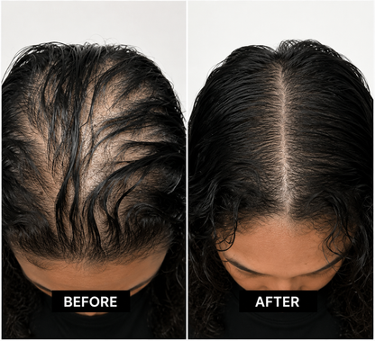 Hair Rescue Oil — Botanical Scalp & Strand Ritual